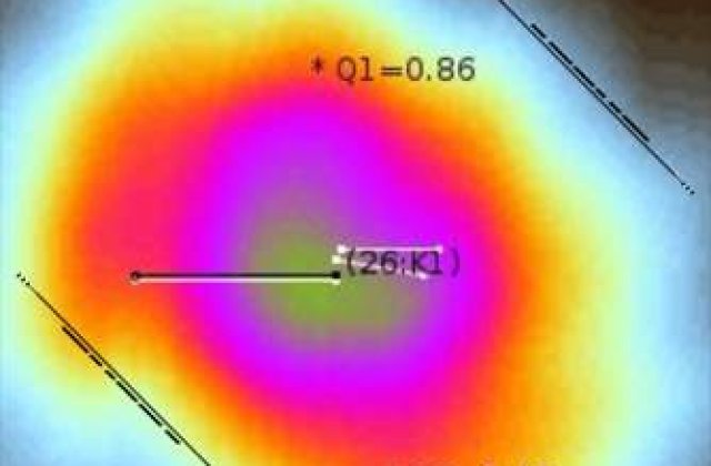 Inventie romaneasca: Aplicatie iPhone ce detecteaza cancerul de piele