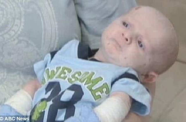 [VIDEO] S-a nascut fara piele