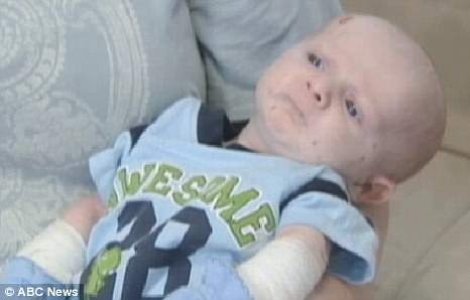  Video  S-a nascut fara piele