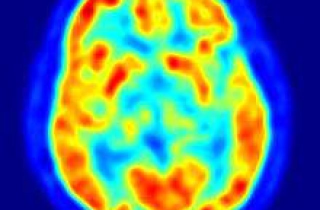 Dragoste sau antidepresive? Care vindeca mai repede?