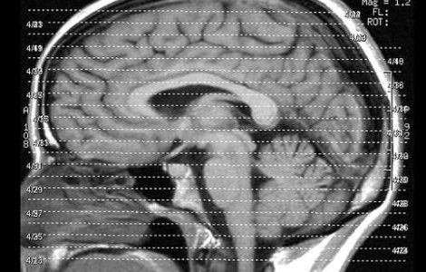 Cum iti antrenezi creierul sa uite?