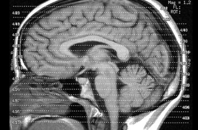 Cum iti antrenezi creierul sa uite?