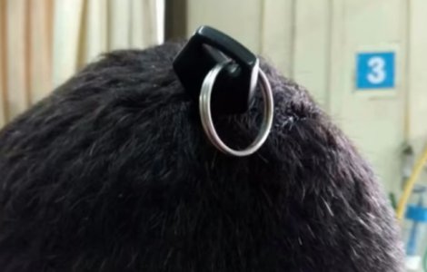 Un tanar de 19 ani a supravietuit cu o cheie infipta in creier/ VIDEO