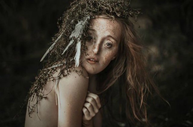 O tanara cu un defect facial rar a spart barierele impuse de lumea modei si si-a facut o cariera in domeniu