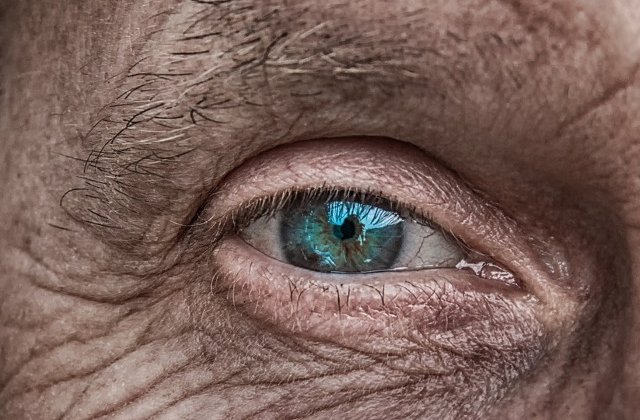 Medicii sustin ca barbatul atacat cu acid de doi tineri ar putea avea nevoie de transplant de cornee