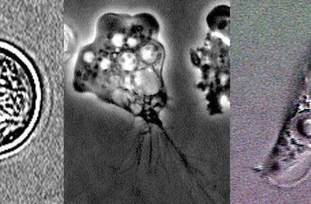 Ce vietate traieste in creierul uman si ucide oameni?