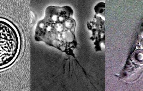 Ce vietate traieste in creierul uman si ucide oameni?