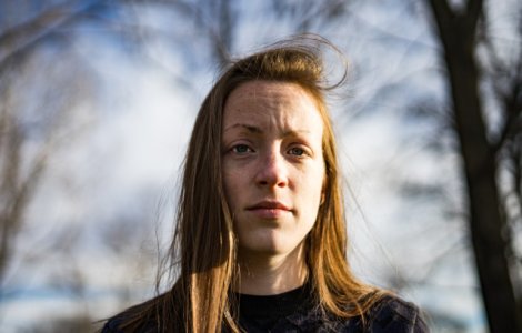 Scleroza multipla afecteaza peste 7.500 de romani. Un pacient pierde, in medie, 10 de ani de viata