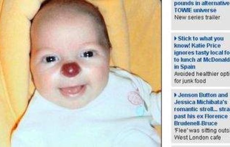 Bebelusul cu nas de clovn!