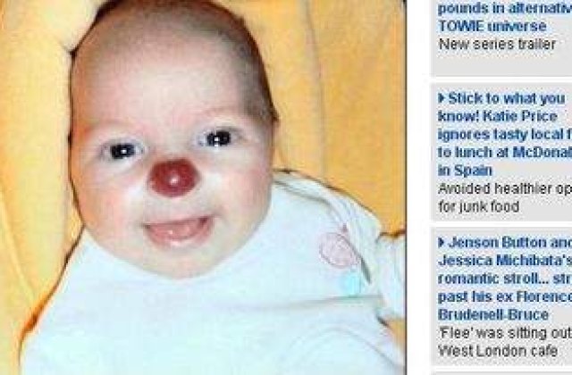 Bebelusul cu nas de clovn!