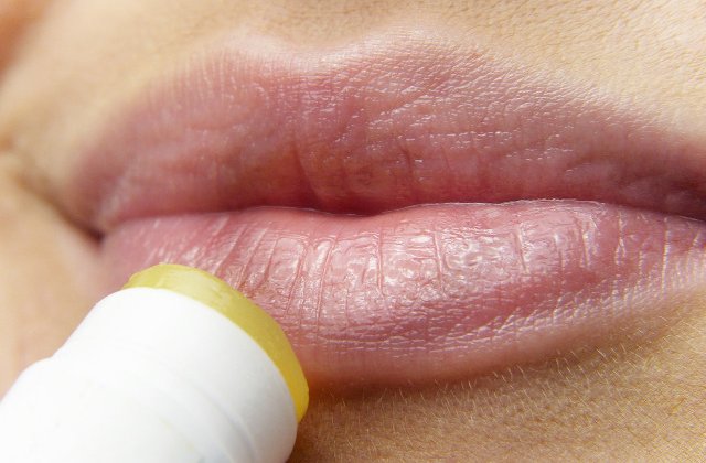 Cum tratezi herpesul: 10 metode simple si eficiente la care poti apela