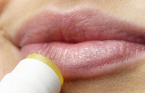  Top  Cum tratezi herpesul: 10 metode simple si eficiente la care poti apela