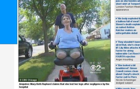  Video  S-a operat pentru a slabi, dar si-a pierdut ambele picioare