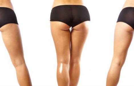 Sayonara celulita! 4 metode de combatere