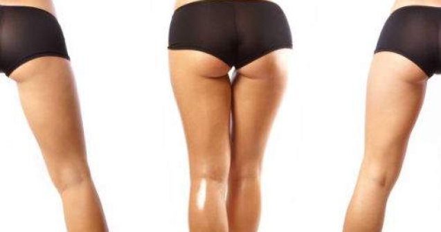 Sayonara celulita! 4 metode de combatere