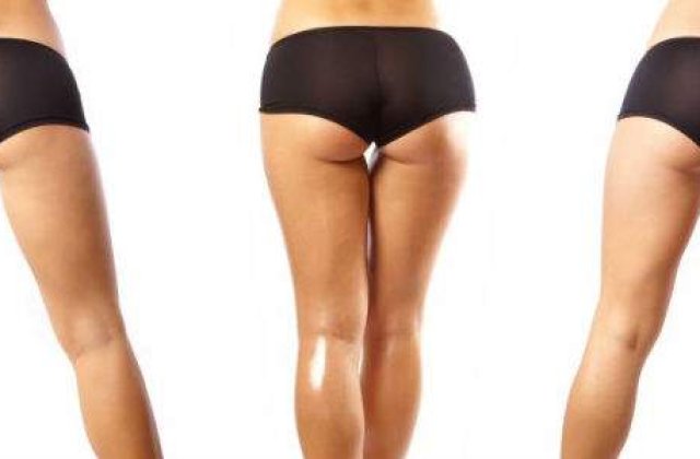 Sayonara celulita! 4 metode de combatere