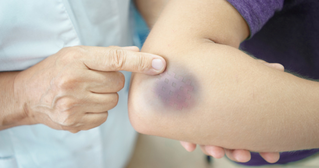  Top  7 motive pentru care te invinetesti foarte repede