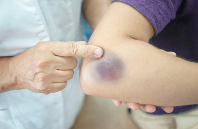 7 motive pentru care te invinetesti foarte repede