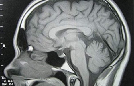 Fotbalistul al carui fiu a invins cancerul: Am ajuns la fundul sacului