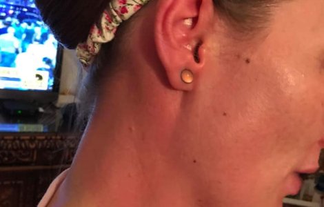 O jurnalista a publicat poze cu ea dupa ce a fost afectata de gazele toxice din Piata Victoriei