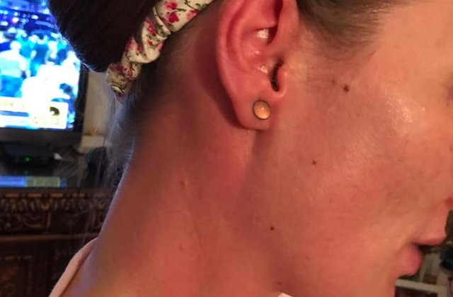 O jurnalista a publicat poze cu ea dupa ce a fost afectata de gazele toxice din Piata Victoriei