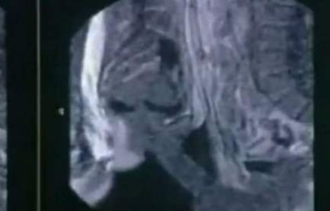  Video  Radiografia corpului uman in timp ce face sex
