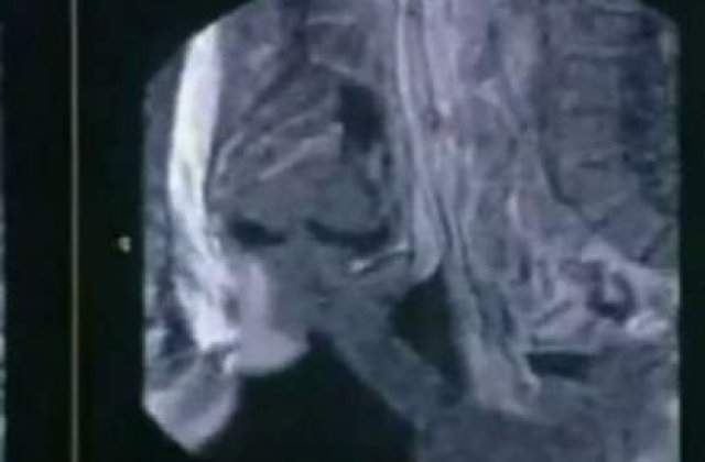 [VIDEO] Radiografia corpului uman in timp ce face sex