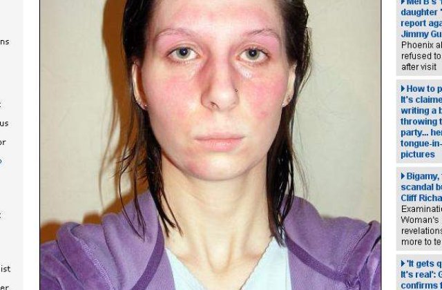 Oare cum e sa fii alergic la ORICE?