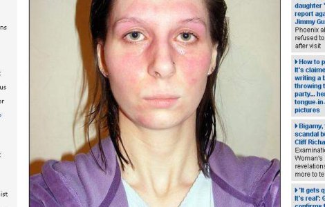 Oare cum e sa fii alergic la ORICE?