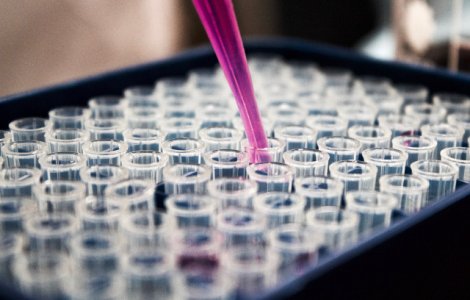 O noua descoperire ii aduce pe cercetatori cu un pas mai aproape de repararea arterelor deteriorate cu ajutorul celulelor stem