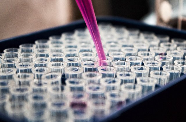 O noua descoperire ii aduce pe cercetatori cu un pas mai aproape de repararea arterelor deteriorate cu ajutorul celulelor stem