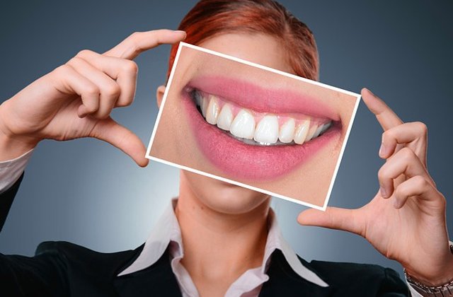 Care sunt criteriile de selectie a unui implant dentar?