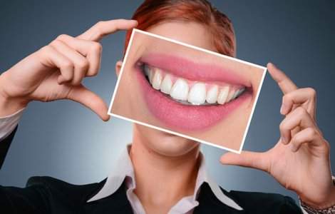 Care sunt criteriile de selectie a unui implant dentar?