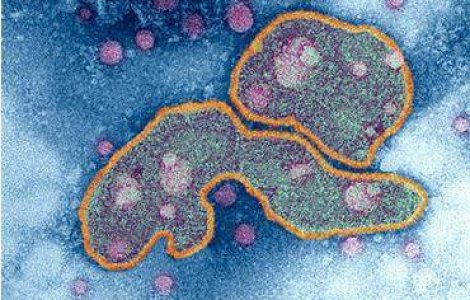 A fost creat un virus mortal