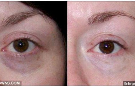 Stiati ca iarna ne face cu 5 ani mai batrane?