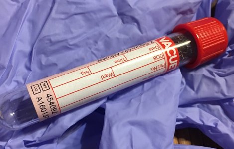 Un test de sange ar putea ajuta femeile care sufera de cancer de san