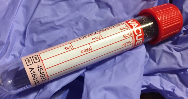 Un test de sange ar putea ajuta femeile care sufera de cancer de san