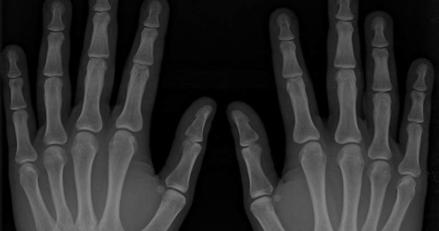  Top  Radiografia pietei locurilor de munca in anul 2011