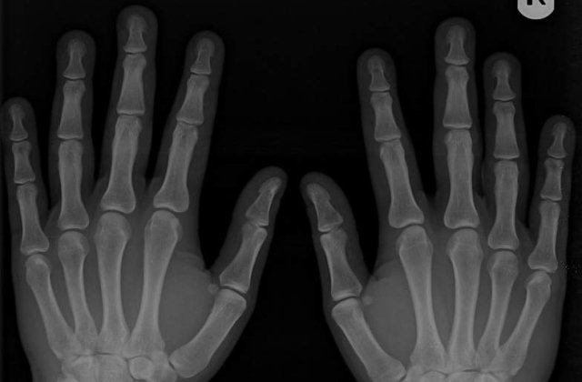 Radiografia pietei locurilor de munca in anul 2011