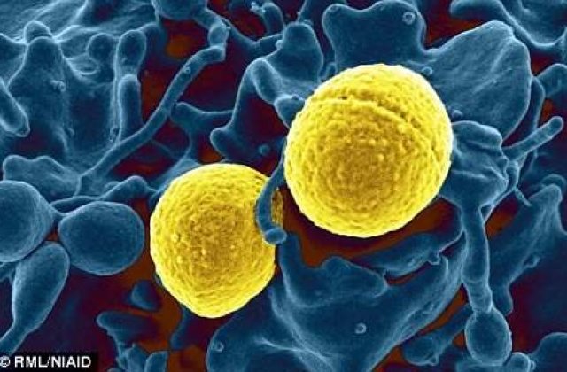 Atentie la BACTERIA care se poate lua din autobuz si poate ataca plamanii