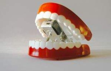 Oferta speciala: Vrei sa cumperi dintii lui Elvis?