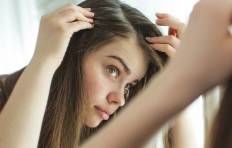  Top  Cum sa acoperi firele albe de par fara sa te vopsesti: 8 metode la care nu te-ai fi gandit