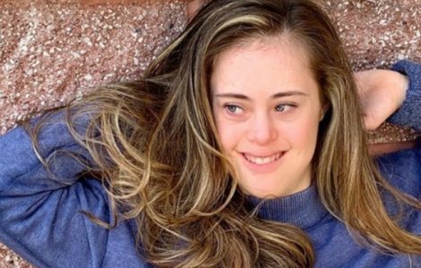O tanara cu sindrom Down, campioana la gimnastica, a devenit model