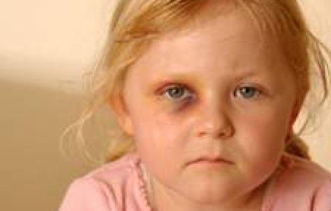 Bataia nu mai e rupta din Rai