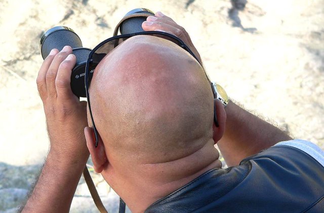 Cercetatorii sunt la un pas de a vindeca cheliile barbatilor