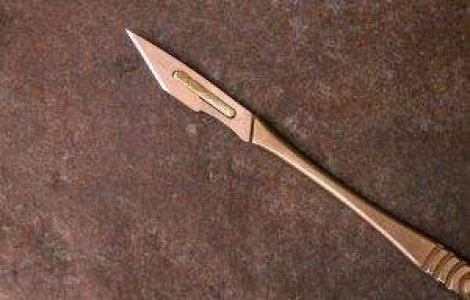 Borcea nu a ascultat sfatul medicilor: I-a sangerat operatia la meciul cu Otelul