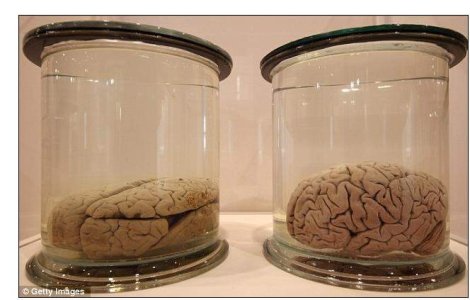 Felie de geniu: Cum arata creierul lui Albert Einstein?