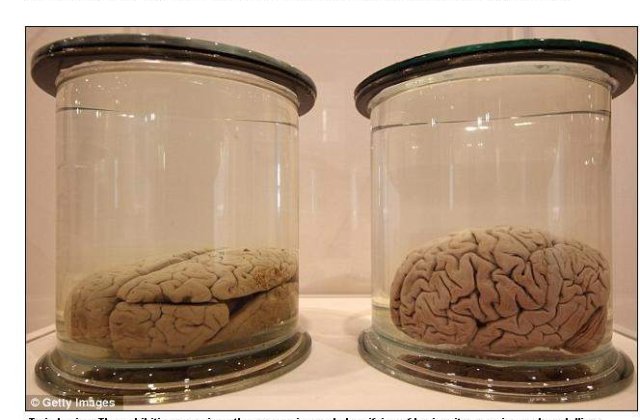 Felie de geniu: Cum arata creierul lui Albert Einstein?