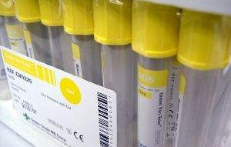 Analize gratuite pentru femei