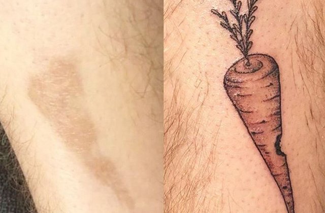 10+ tatuaje care pot transforma cicatricele in adevarate opere de arta